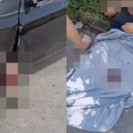 Homem de 45 anos teve a perna amputada | Foto Reprodução / redes sociais