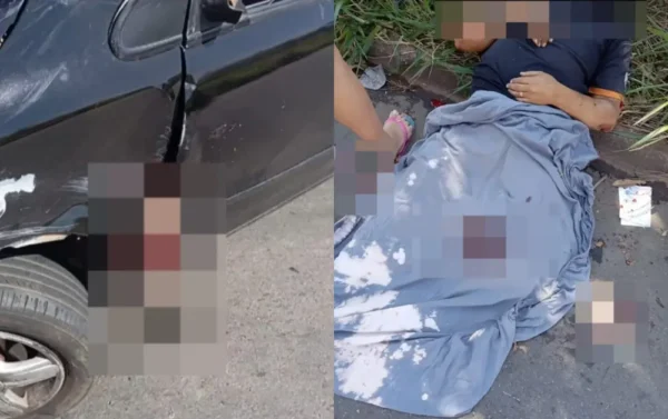 Homem de 45 anos teve a perna amputada | Foto Reprodução / redes sociais
